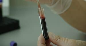 Un nouveau test sanguin prédit le cancer du sein 5 ans à l’avance Test sanguin, Cancer du sein