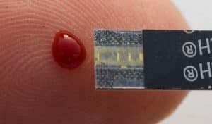 Une goutte de sang révèle toutes les maladies contractées dans votre vie Test sang, VirScan, virus, maladies