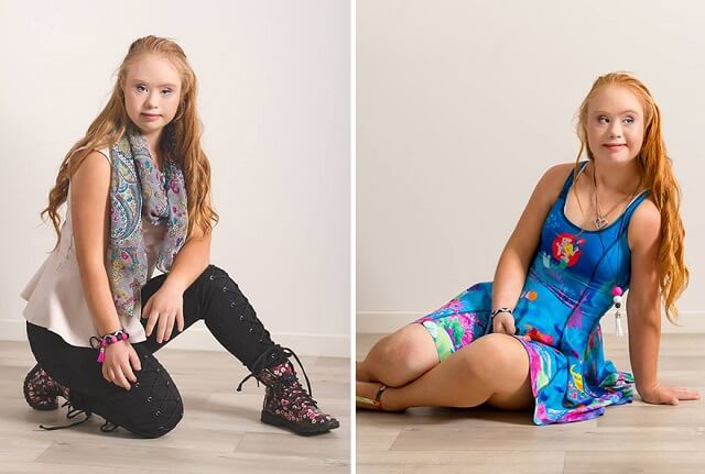 Madeline Stuart, trisomie 21, syndrome de down, mannequin