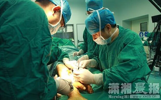 main-jambe-chirurgie-2