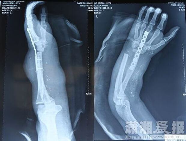 main-jambe-chirurgie-3