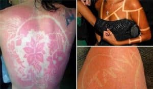 Sunburn art, coup de soleil