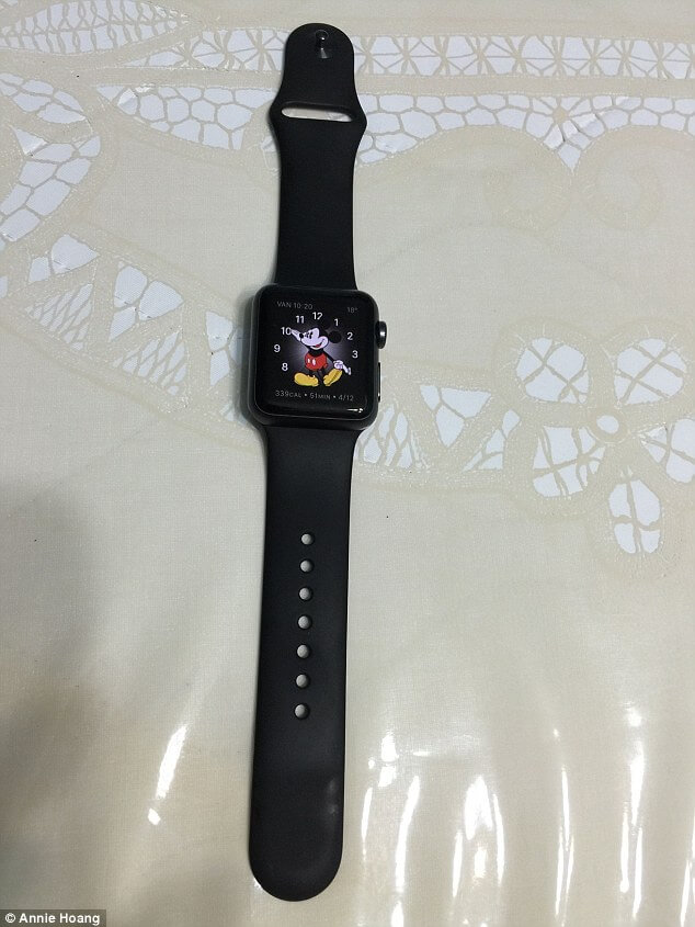 brûlures, Apple Watch