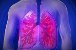 Tuberculose pulmonaire : les risques possibles