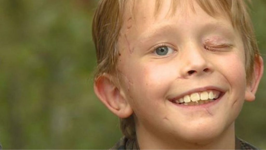 Etats-Unis : Un enfant s’en sort miraculeusement après une attaque de puma